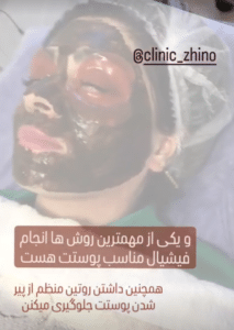 نظر کاربر اینستاگرام (کلینیک زیبایی ژینو)