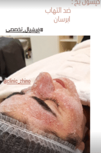 نظر کاربر اینستاگرام (کلینیک زیبایی ژینو)