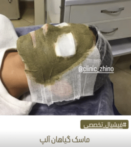 نظر کاربر اینستاگرام (کلینیک زیبایی ژینو)