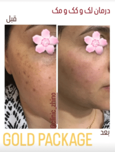 نظر کاربر اینستاگرام (کلینیک زیبایی ژینو)