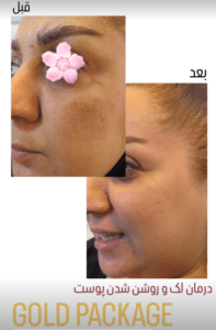 نظر کاربر اینستاگرام (کلینیک زیبایی ژینو)