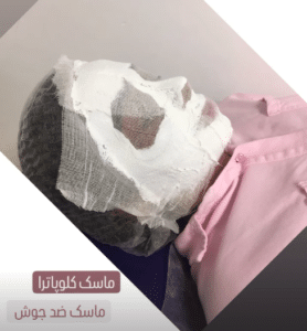 نظر کاربر اینستاگرام (کلینیک زیبایی ژینو)