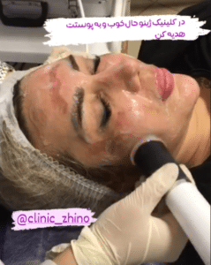 نظر کاربر اینستاگرام (کلینیک زیبایی ژینو)