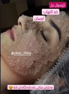 نظر کاربر اینستاگرام (کلینیک زیبایی ژینو)