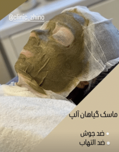 نظر کاربر اینستاگرام (کلینیک زیبایی ژینو)