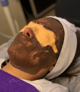 نظر کاربر اینستاگرام (کلینیک زیبایی ژینو)