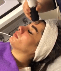 نظر کاربر اینستاگرام (کلینیک زیبایی ژینو)