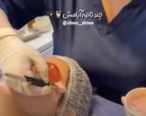 نظر کاربر اینستاگرام (کلینیک زیبایی ژینو)