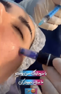 نظر کاربر اینستاگرام (کلینیک زیبایی ژینو)