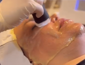 نظر کاربر اینستاگرام (کلینیک زیبایی ژینو)