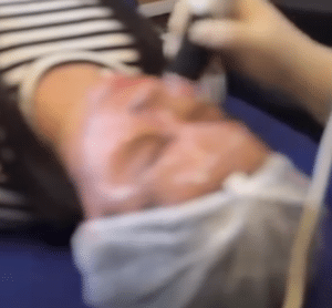 نظر کاربر اینستاگرام (کلینیک زیبایی ژینو)