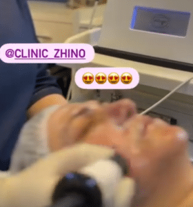 نظر کاربر اینستاگرام (کلینیک زیبایی ژینو)