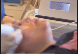 نظر کاربر اینستاگرام (کلینیک زیبایی ژینو)