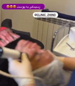 نظر کاربر اینستاگرام (کلینیک زیبایی ژینو)