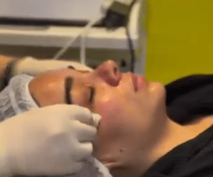 نظر کاربر اینستاگرام (کلینیک زیبایی ژینو)