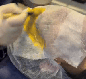 نظر کاربر اینستاگرام (کلینیک زیبایی ژینو)