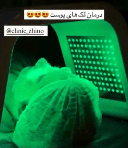 نظر کاربر اینستاگرام (کلینیک زیبایی ژینو)