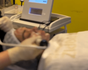 نظر کاربر اینستاگرام (کلینیک زیبایی ژینو)