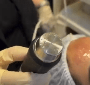 نظر کاربر اینستاگرام (کلینیک زیبایی ژینو)