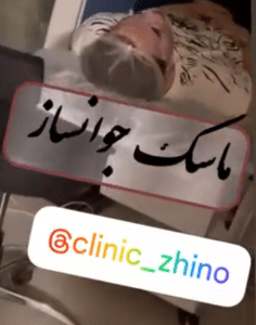 نظر کاربر اینستاگرام (کلینیک زیبایی ژینو)