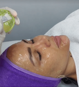 نمونه پاکسازی پوست کلینیک زیبایی الگانت