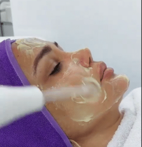 نمونه پاکسازی پوست کلینیک زیبایی الگانت