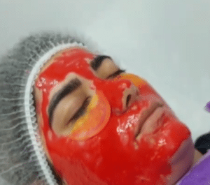 نمونه پاکسازی پوست کلینیک زیبایی الگانت