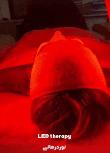 نمونه پاکسازی پوست کلینیک زیبایی الگانت