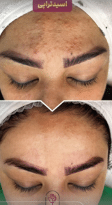 نمونه پاکسازی پوست کلینیک زیبایی الگانت