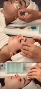 نمونه پاکسازی پوست کلینیک زیبایی الگانت