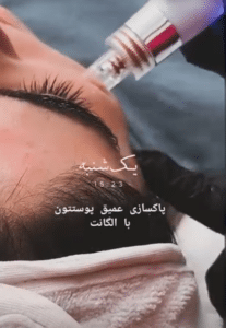 نمونه پاکسازی پوست کلینیک زیبایی الگانت