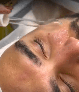 نمونه پاکسازی پوست کلینیک زیبایی الگانت