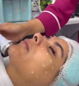 نمونه پاکسازی پوست کلینیک زیبایی الگانت