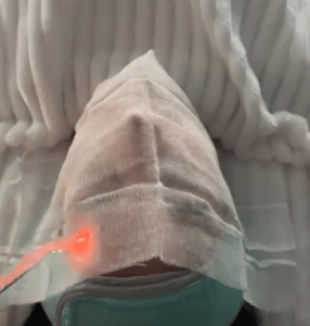 نمونه پاکسازی پوست کلینیک زیبایی الگانت