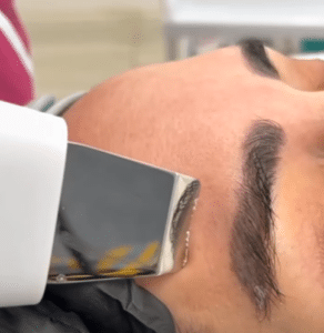 نمونه پاکسازی پوست کلینیک زیبایی الگانت