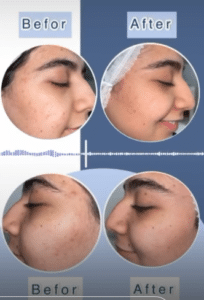 نمونه پاکسازی پوست کلینیک زیبایی صدف