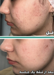 نمونه پاکسازی پوست کلینیک زیبایی صدف