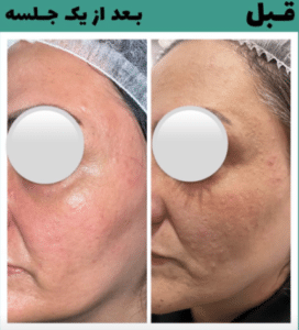 نمونه پاکسازی پوست کلینیک زیبایی صدف