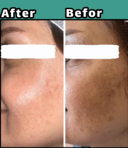 نمونه پاکسازی پوست کلینیک زیبایی صدف