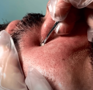 نمونه پاکسازی پوست کلینیک زیبایی صدف