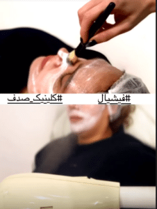 نمونه پاکسازی پوست کلینیک زیبایی صدف