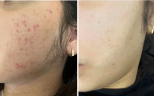 نمونه پاکسازی پوست کلینیک زیبایی صدف