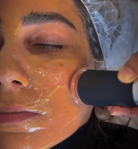 نمونه پاکسازی پوست کلینیک زیبایی صدف