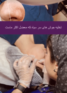 نمونه پاکسازی پوست کلینیک زیبایی صدف