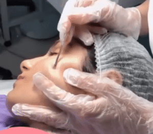 نمونه پاکسازی پوست کلینیک زیبایی صدف