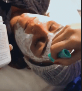 نمونه پاکسازی پوست کلینیک زیبایی صدف