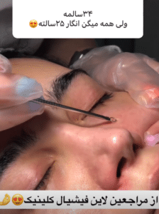 نمونه پاکسازی پوست کلینیک زیبایی صدف