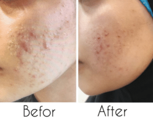 نمونه پاکسازی پوست کلینیک زیبایی صدف