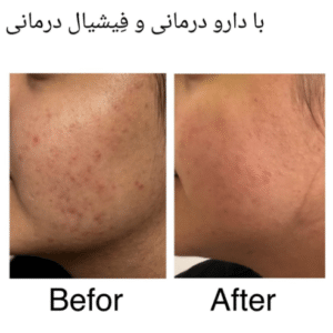 نمونه پاکسازی پوست کلینیک زیبایی صدف