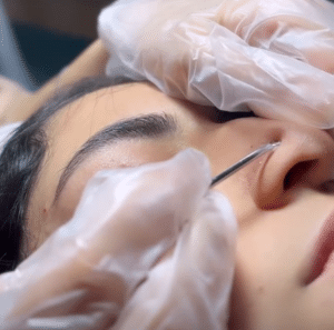 نمونه پاکسازی پوست کلینیک زیبایی صدف